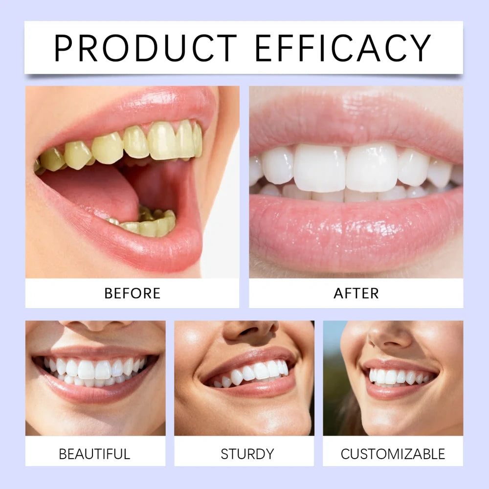 Feimuko Teeth Whitening Strips